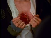 Chris' wound