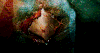 Lunapic 137158421719519 1