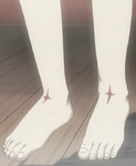 Rosette's ankle marks.