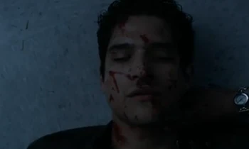 Tyler Posey in Teen Wolf: Status Asthmaticus