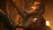 Richard Dormer in Game of Thrones: Kissed By Fire