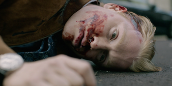 FreddieFox-SlowHorses-HeadTrauma