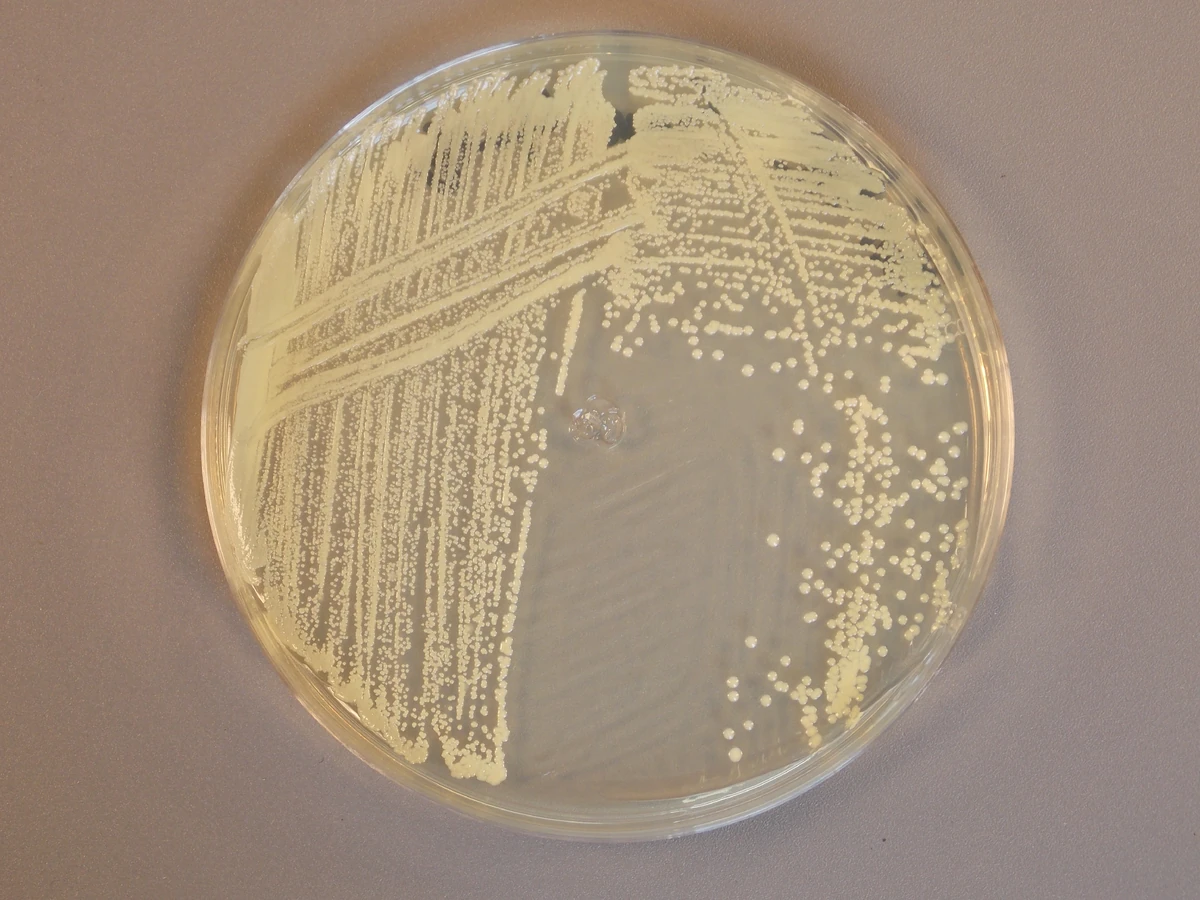 Staphylococcus | Classroom Bacterial Identification Wiki | Fandom