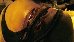 A detailed image of a Parasite Bite.
