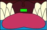 Whale's Mouth igloo icon