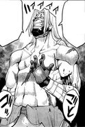 Issin's multiple self inflicted scars.