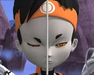 Улриков полиморфни клон.