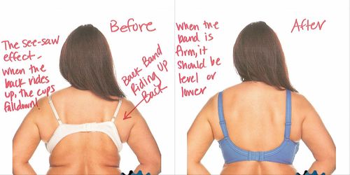 How a Properly Fitting Bra Can Solve the Armpit Fat Issue
