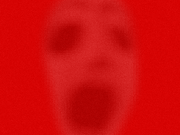 Migraine1