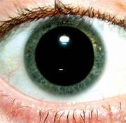 Dilate