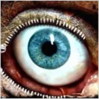 Holderseye