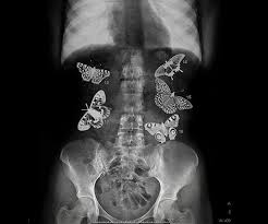 Butterflies In Your Stomach Creepypasta Wiki Fandom