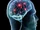The Other Eighty Percent of the Brain