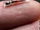 Implanted