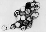 200px-Rubella virus TEM B82-0203 lores