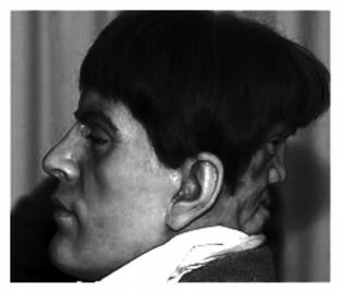 EdwardMordake