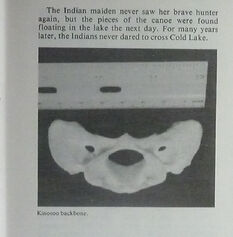Kinosoo back bone