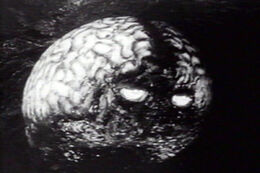 Brainguy