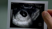 Sonogram-of-Lucy-lucy-messer-7862581-624-352