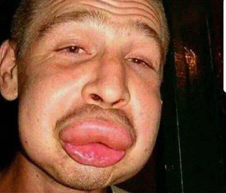 Big Lips Da Bois Wiki Fandom Big Lips Da Bois Wiki Fandom