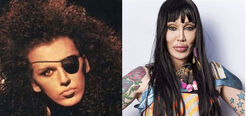 Pete Burns, the controversial singer of the band Dead Or Alive