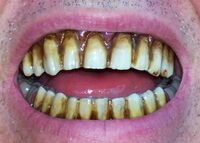 Zombie Teeth.jpg