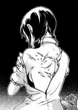 Minatsuki's scars.