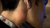 An example of a Zombrex GPS chip from Dead Rising 3 seen on Brad Park's neck