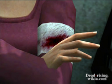 Dead rising simone's bite