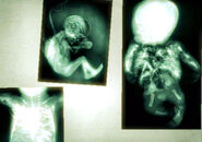 X-ray imagings of a supposed Lurker in Dead Space.