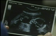 Jenna's ultrasound picture baby 10-09-10 pregnant degrassi season 10