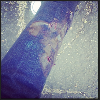 Lena's wounded leg