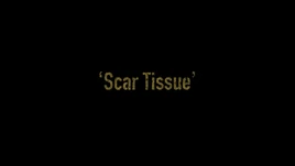 84 Scar Tissue