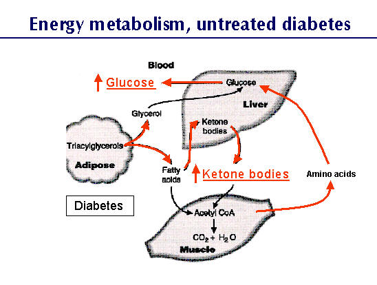 Diabetes - Wikipedia