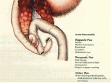 Pancreatitis
