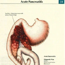 Pancreatitis Canine Diabetes Wiki Fandom