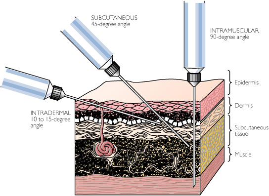 intramuscular injection sites in dogs