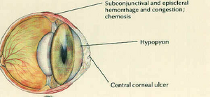 Cornea