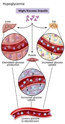 Hypoglycemia