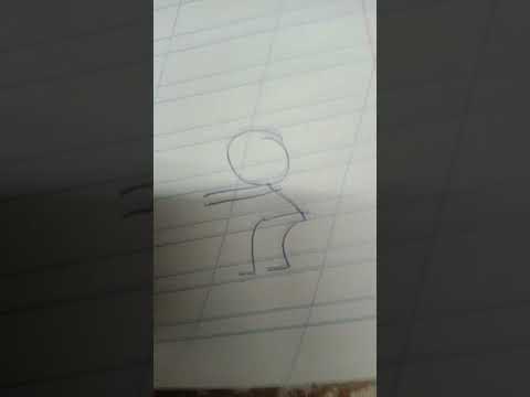 When a scar looks like a dancing stickman - Meme by I_NoSc0pedJFK