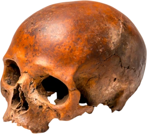 Skull