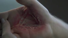 Neil's branded hand after using the key to the vault.