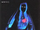 Beating-Heart Bride