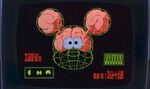 Mickey's brain