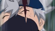 Kakashi get's his right eye stabbed.