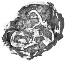 Lower Deadwood Ridge