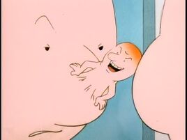 Doug's Huge Zit