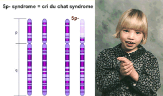 Cri du chat450