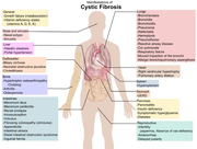 500px-Cystic fibrosis manifestations