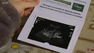 Ricky Mitchell and Lily Slater Baby Scan Print out (15 February 2023)
